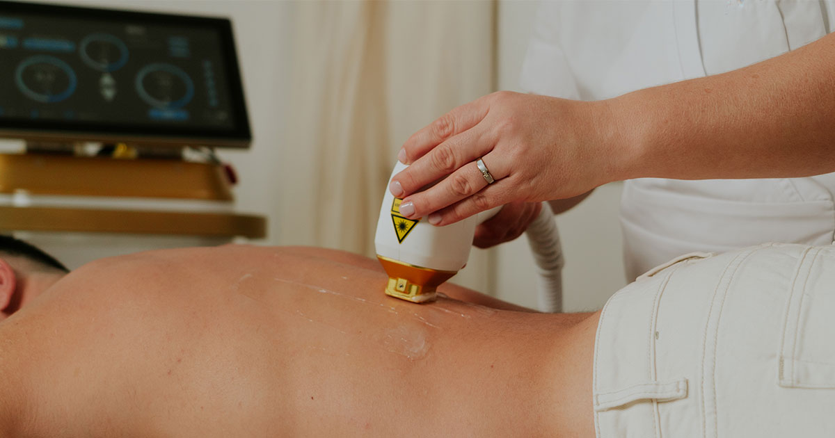 épilation définitive dos homme rapide avec le spot laser large